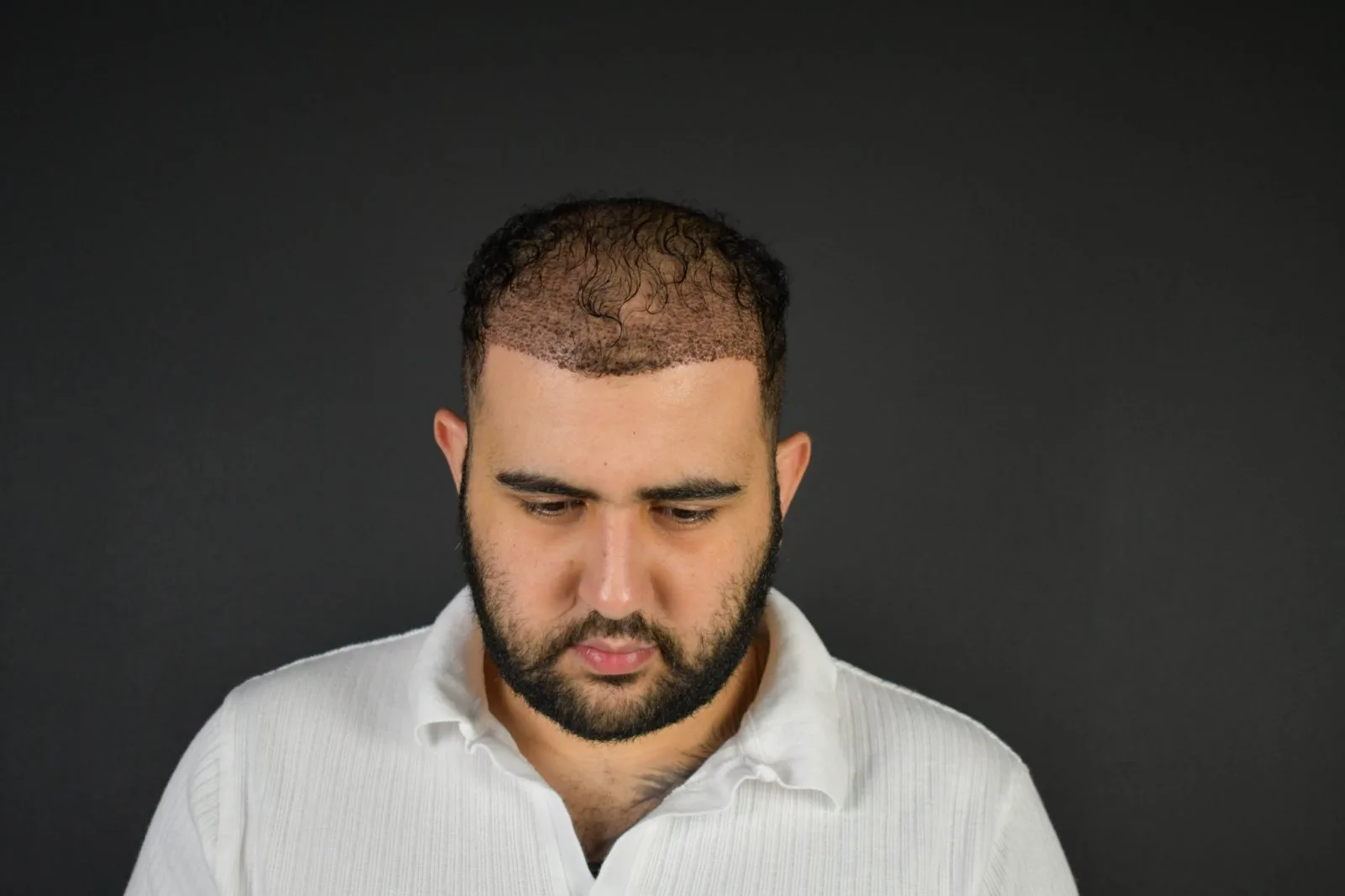 Man with receding hairline looking downward against dark background
